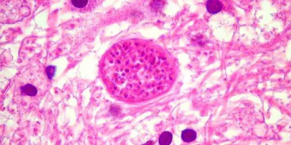 Toxoplasma gondii é o causador da toxoplasmose