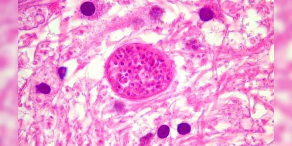 Toxoplasma gondii é o causador da toxoplasmose