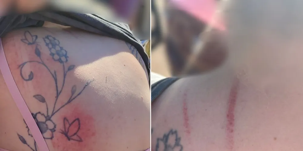 Motorista foi agredida após finalizar uma 'corrida' de aplicativo