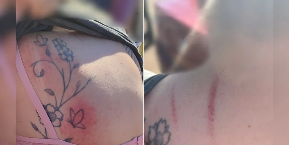 Motorista foi agredida após finalizar uma 'corrida' de aplicativo