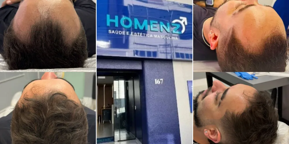 Homenz é referência em saúde e estética no município de Ponta Grossa