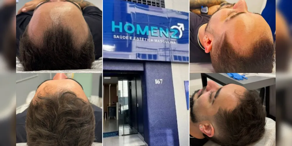 Homenz é referência em saúde e estética no município de Ponta Grossa