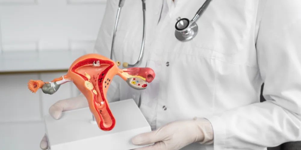 O Papanicolau, realizado de forma anual, é capaz de identificar essas alterações ainda na fase inicial