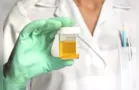 Cientistas criam material para implantes dentários a partir de xixi