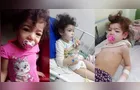 Família de São João do Triunfo pede ajuda para criança com microcefalia e síndrome nefrótica