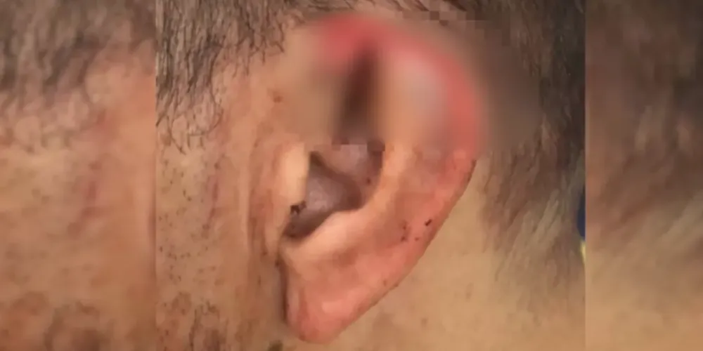 Homem de 29 anos foi detido após morder e arrancar parte da orelha de seu companheiro, de 19 anos