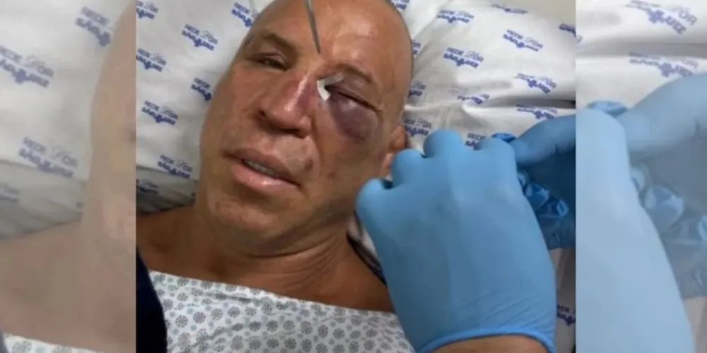 Wanderlei foi nocauteado