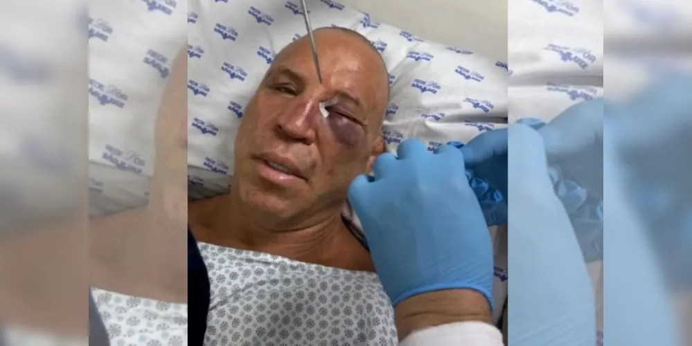 Wanderlei foi nocauteado