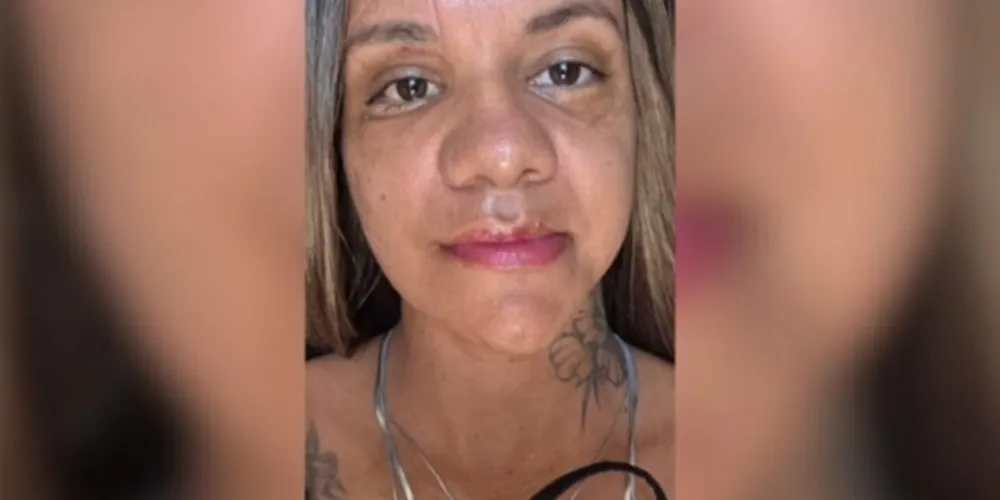 A cirurgia contou com uma equipe multidisciplinar composta por cirurgiões-dentistas especializados