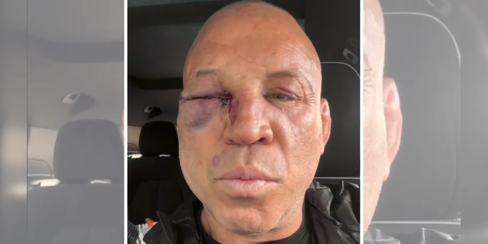 Atleta também agradeceu ao apoio e aos que se preocuparam com seu estado de saúde