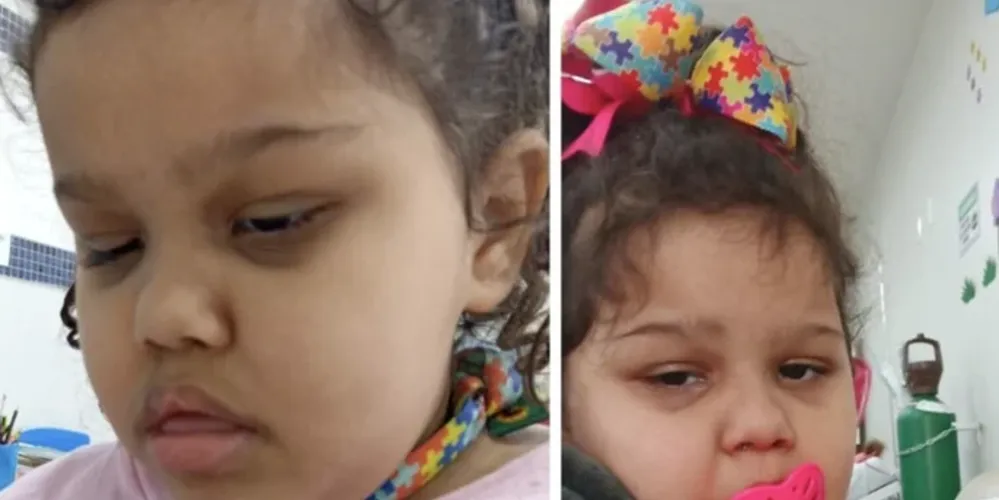 Bryene Victória precisa da medicação de Canabidiol 200mg.