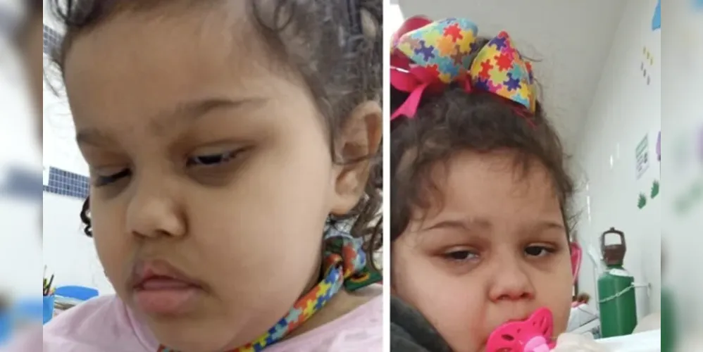 Bryene Victória precisa da medicação de Canabidiol 200mg.
