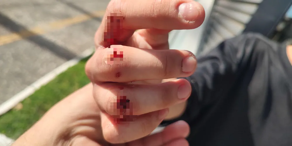 Adolescente de 16 anos sofreu agressão por morador de rua.