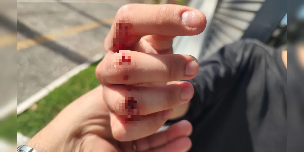 Adolescente de 16 anos sofreu agressão por morador de rua.