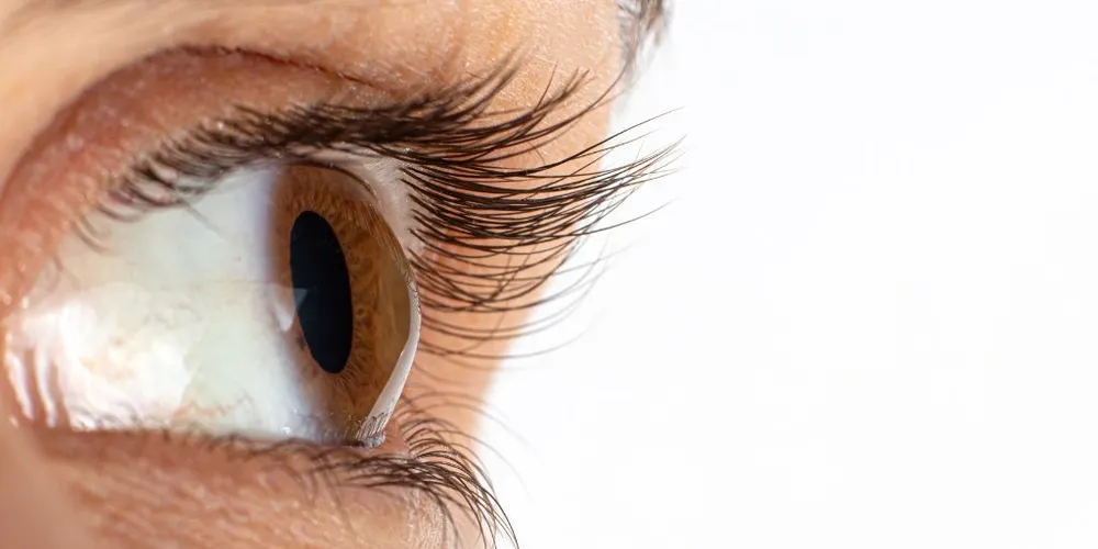 Os olhos ficam em um formato cônico, levando à visão embaçada, astigmatismo irregular e sensibilidade à luz