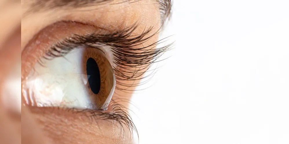 Os olhos ficam em um formato cônico, levando à visão embaçada, astigmatismo irregular e sensibilidade à luz