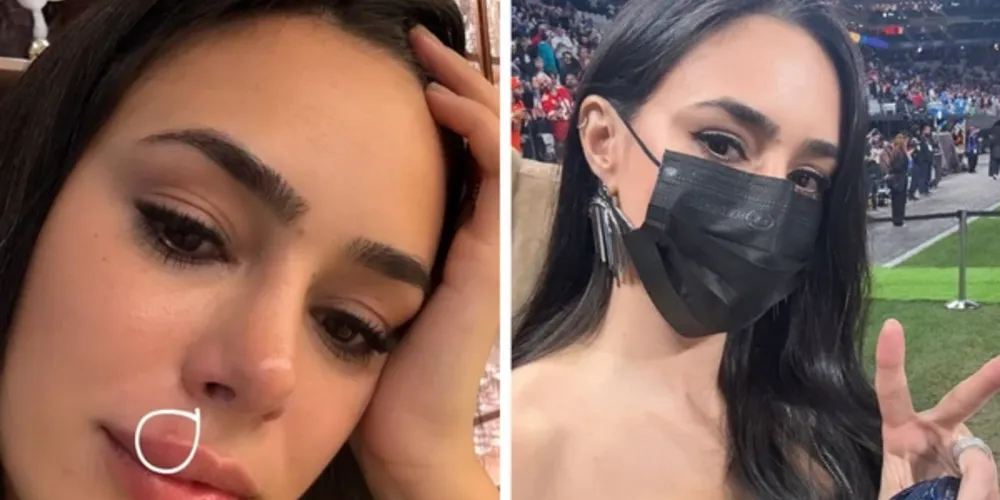 Esposa de Neymar usou máscara em evento para esconder inchaço