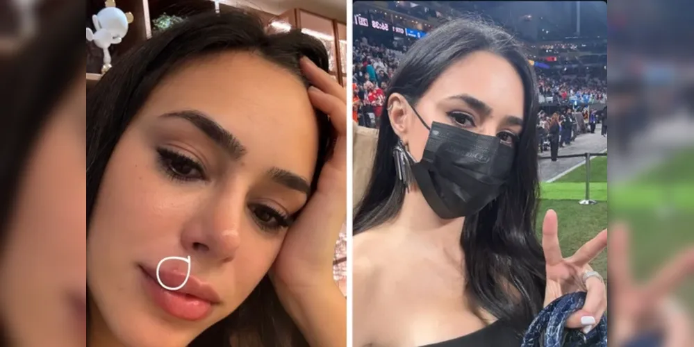 Esposa de Neymar usou máscara em evento para esconder inchaço