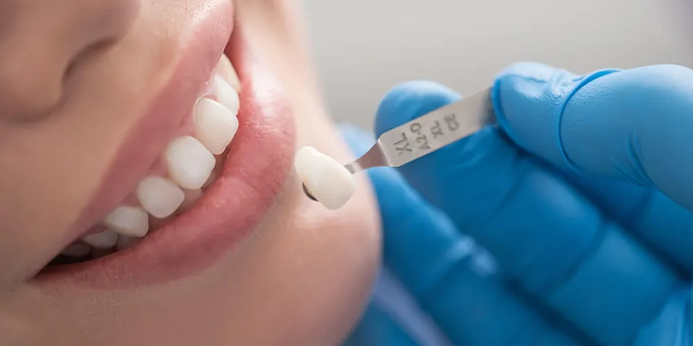 Agende agora sua avaliação estética na Fisiodonto Med e descubra o sorriso que combina com a sua identidade.