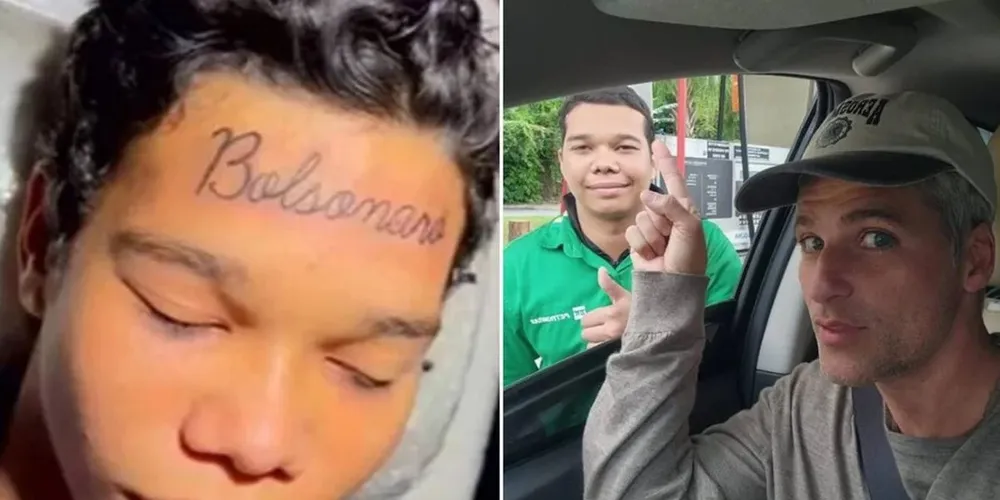 Jovem removeu a tatuagem