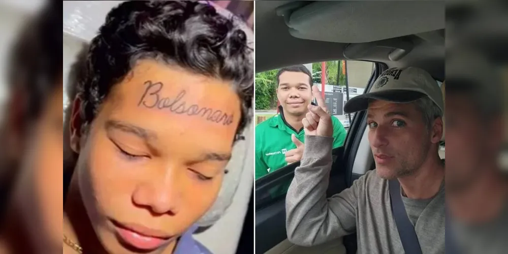 Jovem removeu a tatuagem