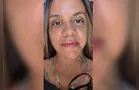 Mulher agredida com 61 socos mostra resultado de reconstrução facial