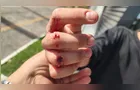 Jovem leva 'paulada' de morador de rua em Ponta Grossa