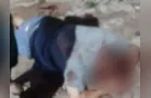 Homem fica em estado grave após ser atacado por cães da raça Pitbull