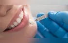 Estética Odontológica: o sorriso que cabe na sua identidade não se improvisa
