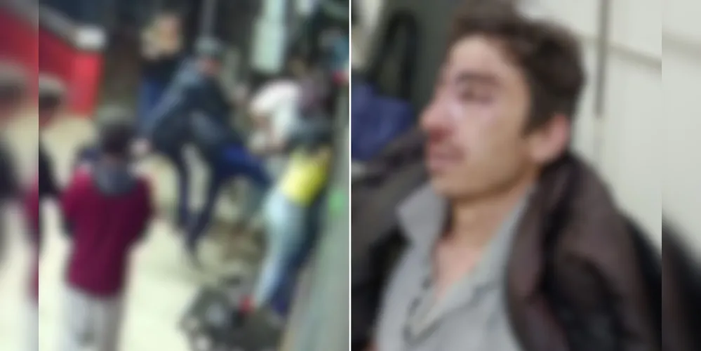 Gabriel Emanuel de Souza tem 24 anos e apresenta problemas neurológicos