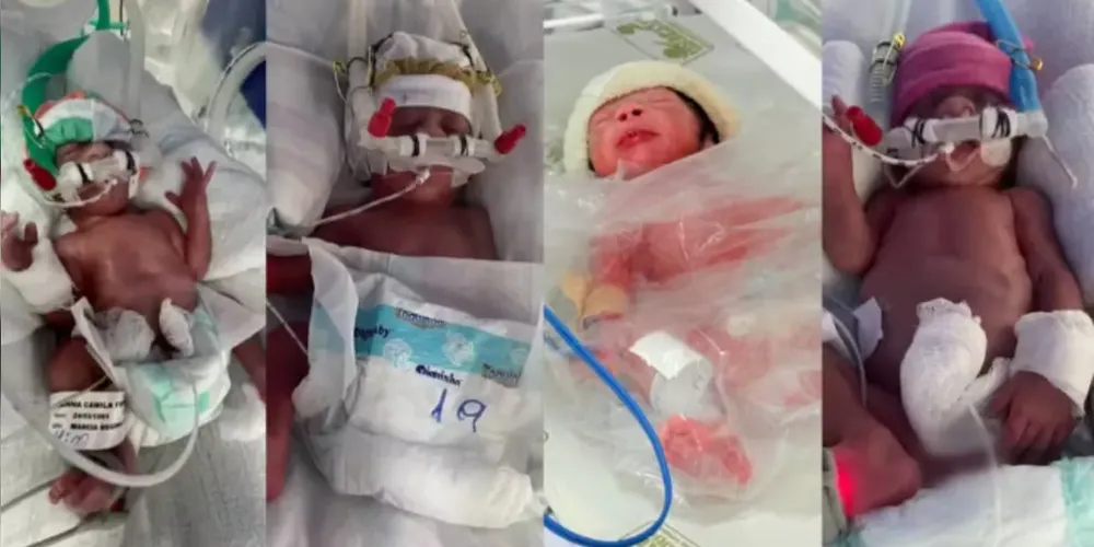 Os quadrigêmeos nasceram na última sexta-feira (24)