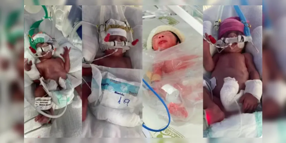 Os quadrigêmeos nasceram na última sexta-feira (24)