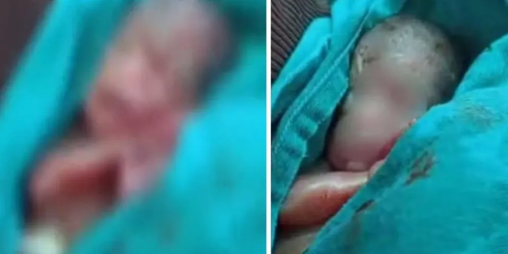 Corpo ficou cerca de 12 horas em um saco antes de ser levado para o velório