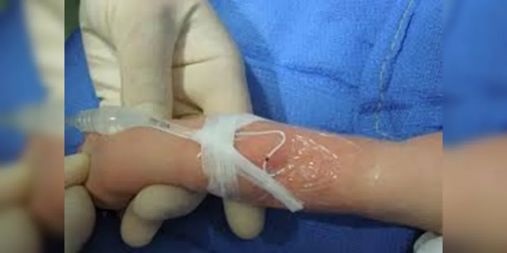 Paraná registra 2.060 incidentes associados aos cuidados em saúde em recém-nascidos entre 2014 e 2022