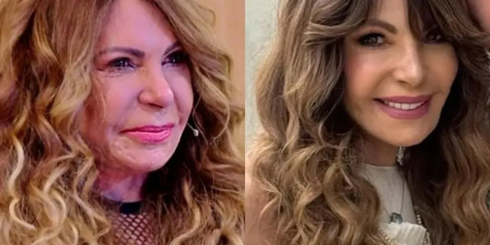 Antes e depois da artista chamou a atenção nas redes sociais