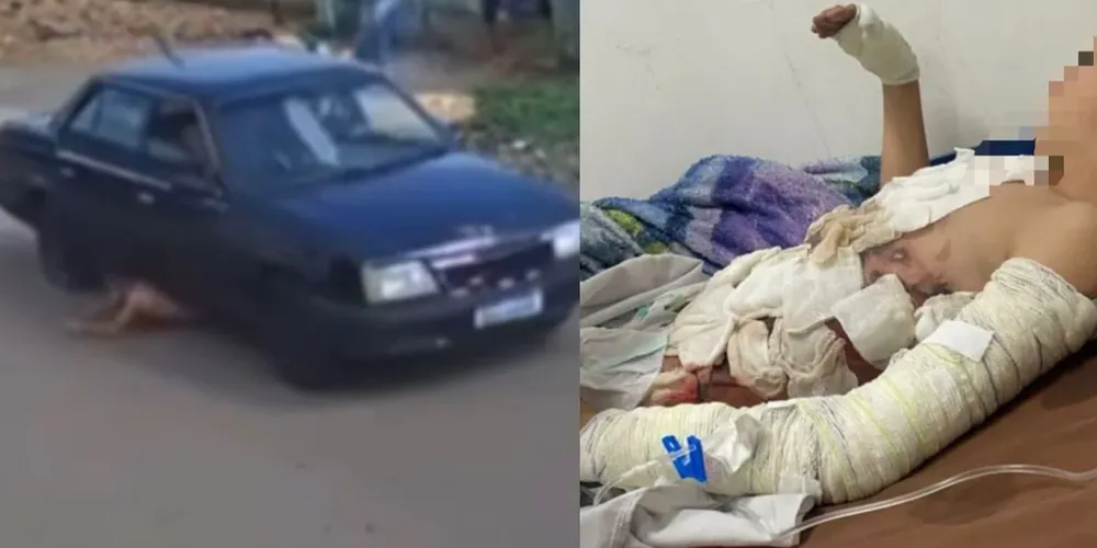 O impacto foi tão violento que a criança ficou presa sob o carro e foi arrastada por alguns metros