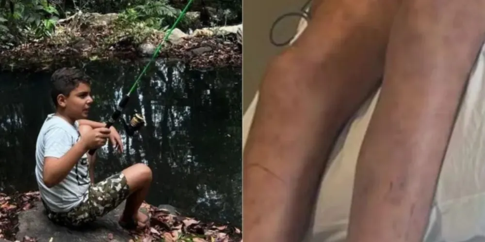 João Pedro estava internado desde o dia 13 de novembro, quando foi atacado por enxame de abelhas