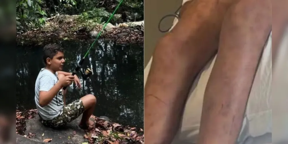 João Pedro estava internado desde o dia 13 de novembro, quando foi atacado por enxame de abelhas