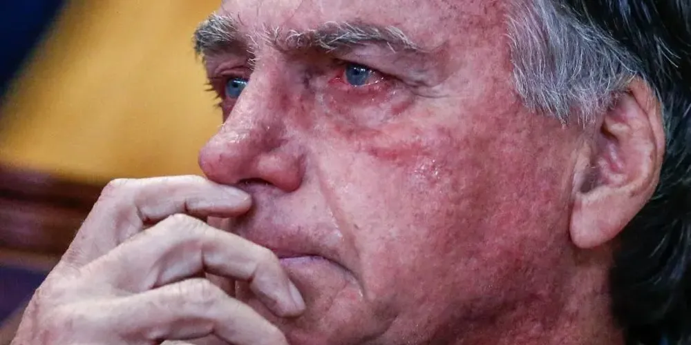 A informação foi repassada pela equipe médica responsável pelo acompanhamento de Bolsonaro