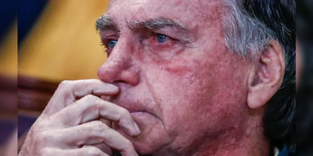 A informação foi repassada pela equipe médica responsável pelo acompanhamento de Bolsonaro