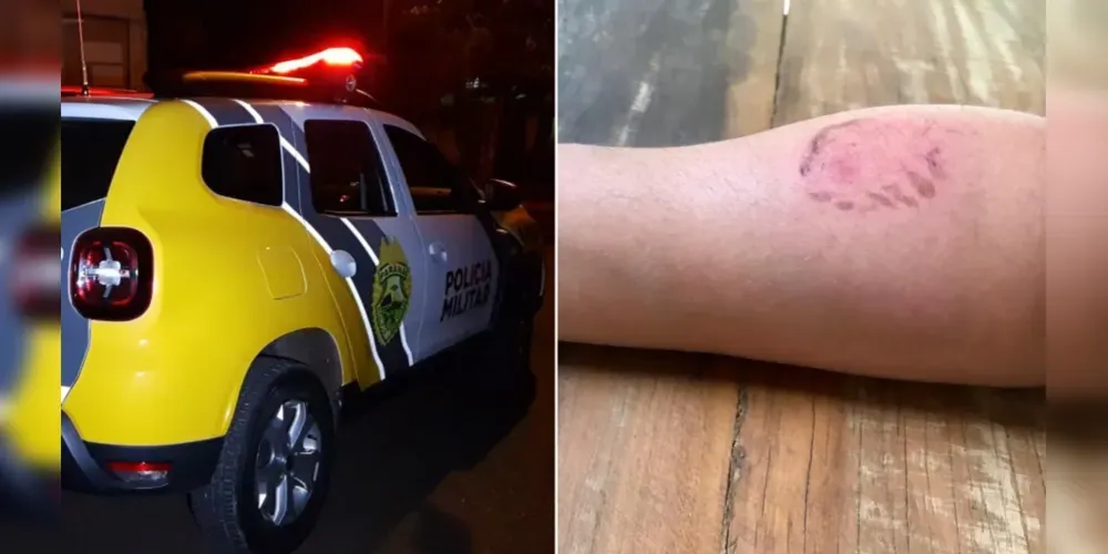 Mulher sofreu chutes e foi mordida