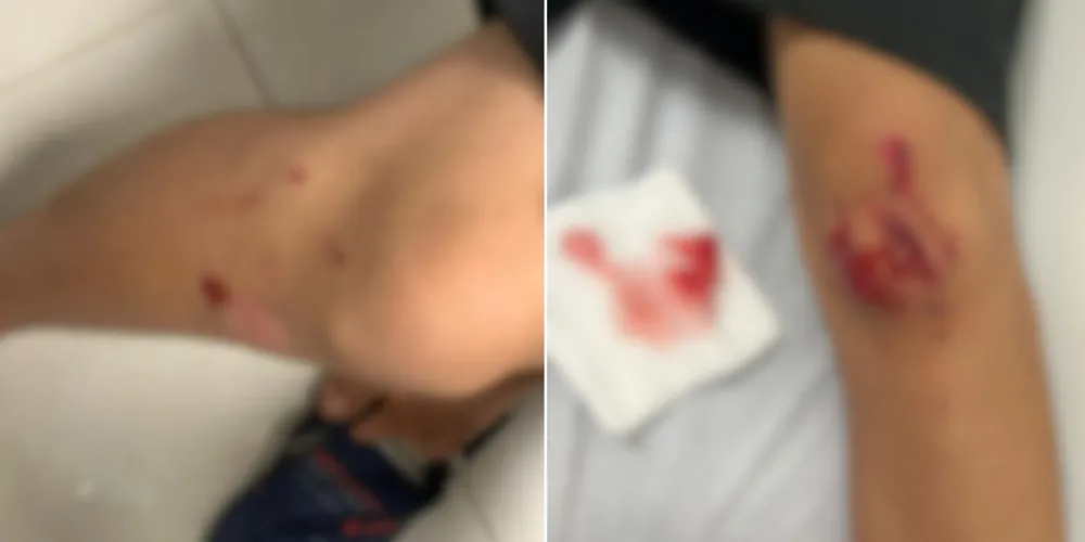 Os meninos agredidos receberam atendimento médico