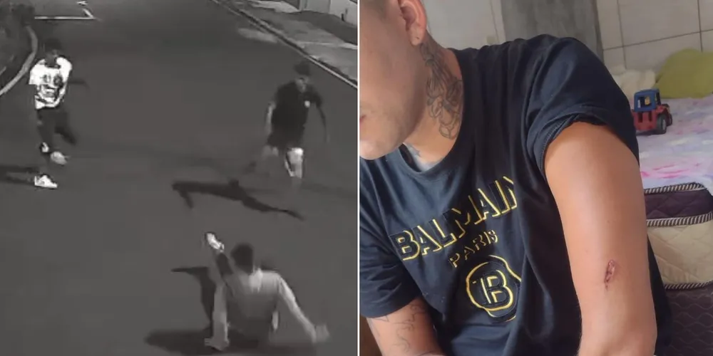 Diogo ficou ferido no braço após ter sido atingido enquanto tentava separar a briga