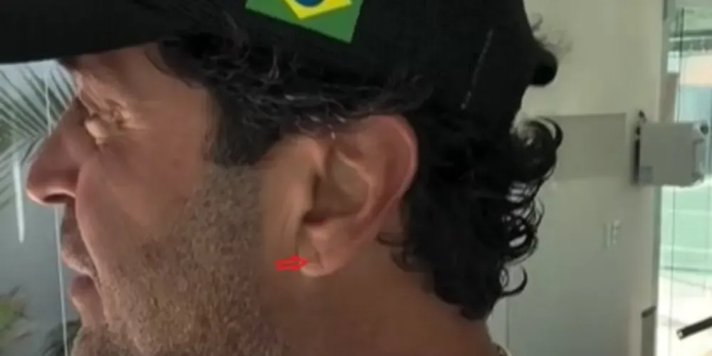 Marca no lóbulo da orelha virou notícia após a morte do influenciador