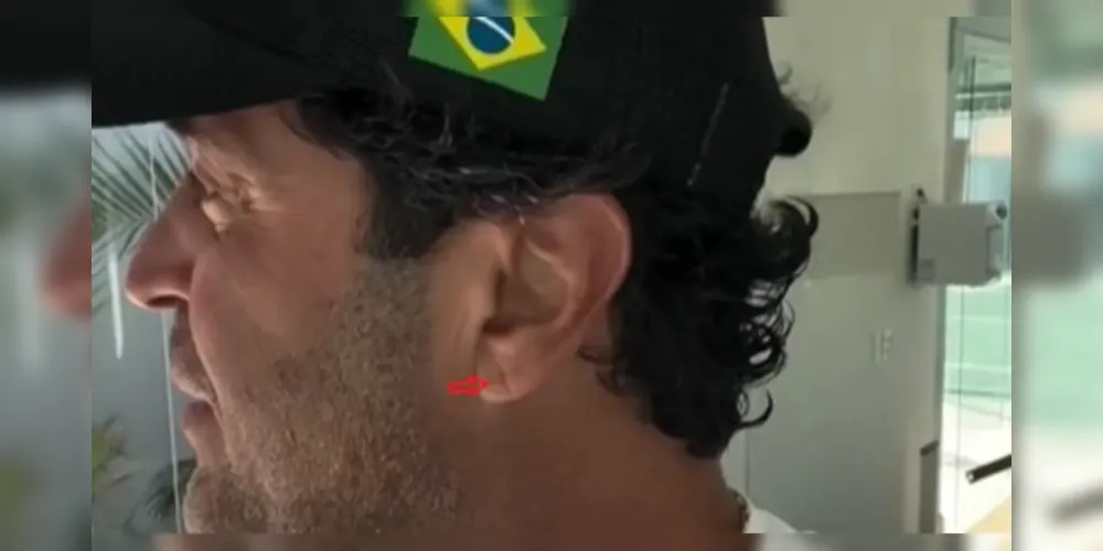 Marca no lóbulo da orelha virou notícia após a morte do influenciador