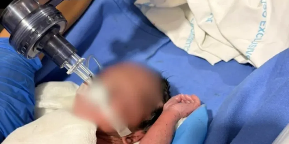 Após intensos procedimentos de emergência, o bebê respondeu às manobras