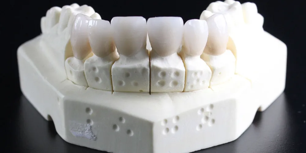 Procedimento hoje é marcado pela previsibilidade clínica e por protocolos cada vez mais precisos, respaldados por evidências científicas consolidadas