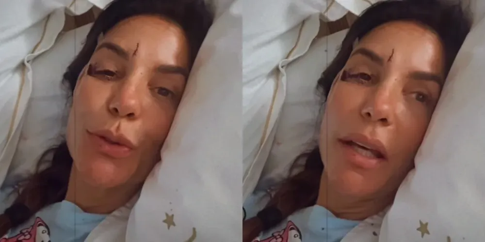 No vídeo, a cantora mostrou um corte na região do supercílio causado no momento da queda