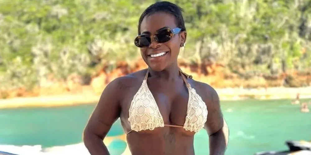 Ela fez cirurgia bariátrica, acompanhamento médico para perder peso