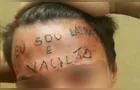 Jovem tatuado na testa com 'ladrão e vacilão' é preso furtando UBS na Grande SP